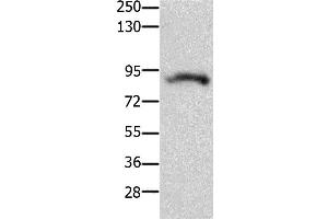 Western Blotting (WB) image for anti-Potassium Voltage-Gated Channel, Subfamily H (Eag-Related), Member 2 (KCNH2) antibody (ABIN2426047) (KCNH2 抗体)