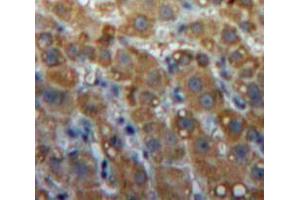 Used in DAB staining on fromalin fixed paraffin-embedded Liver tissue (LIPG 抗体  (AA 115-369))