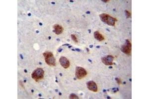 Immunohistochemistry (IHC) image for anti-Bone Morphogenetic Protein Receptor, Type IB (BMPR1B) (AA 134-162) antibody (ABIN3030188)