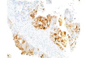 Immunohistochemistry (IHC) image for anti-Indoleamine 2,3-Dioxygenase 1 (IDO1) (AA 1-403) antibody (ABIN7449541) (Recombinant IDO1 抗体  (AA 1-403))