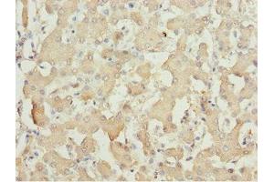 Immunohistochemistry of paraffin-embedded human liver tissue using ABIN7143362 at dilution of 1:100 (MOCS3 抗体  (AA 271-460))