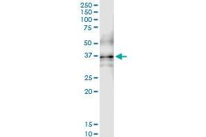 Immunoprecipitation of QPCT transfected lysate using anti-QPCT MaxPab rabbit polyclonal antibody and Protein A Magnetic Bead , and immunoblotted with QPCT purified MaxPab mouse polyclonal antibody (B01P) . (QPCT 抗体  (AA 1-361))