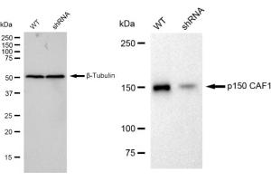 Western blotting analysis using p150 CAF1 antibody (ABIN7798058).