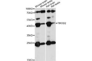 Western blot analysis of extracts of various cell lines, using TMOD2 antibody (ABIN6291659) at 1:1000 dilution. (TMOD2 抗体)