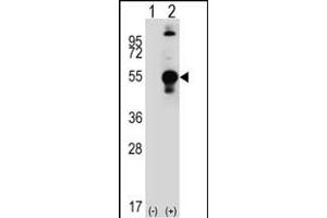Western blot analysis of LECT1 (arrow) using rabbit polyclonal LECT1 Antibody (C-term) (ABIN389196 and ABIN2839359). (LECT1 抗体  (C-Term))