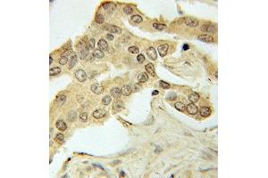 Immunohistochemistry (IHC) image for anti-Protein Kinase, AMP-Activated, alpha 1 Catalytic Subunit (PRKAA1) (AA 1-300) antibody (ABIN3021788)