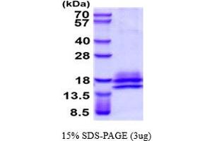 SDS-PAGE (SDS) image for Interleukin 3 (IL-3) (AA 20-152) (Active) protein (His tag) (ABIN7529333) (IL-3 Protein (AA 20-152) (His tag))