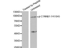 Western blot analysis of extracts from SW626 cells using Phospho-CTNNB1-T41/S45 antibody. (CTNNB1 抗体  (pSer45, pThr41))