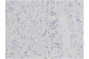ABIN6267470 at 1/200 staining Human esophagus tissue sections by IHC-P. (AKT1 抗体  (pThr450))
