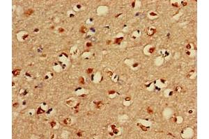 Immunohistochemistry of paraffin-embedded human brain tissue using ABIN7158354 at dilution of 1:100 (LIM Domain Kinase 1 抗体  (AA 179-320))