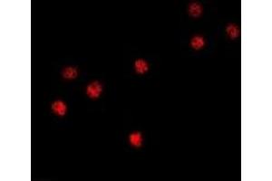 Immunofluorescent analysis of BOB1 staining in HT29 cells. (POU2AF1 抗体)