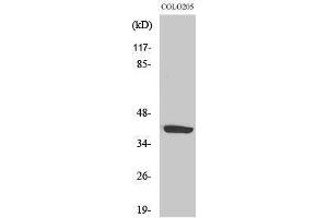 Western Blotting (WB) image for anti-Purinergic Receptor P2Y, G-Protein Coupled, 14 (P2RY14) (Internal Region) antibody (ABIN3180067) (P2RY14 抗体  (Internal Region))