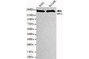 Western Blotting (WB) image for anti-SWI/SNF Related, Matrix Associated, Actin Dependent Regulator of Chromatin, Subfamily A, Member 4 (SMARCA4) antibody (ABIN6241306)