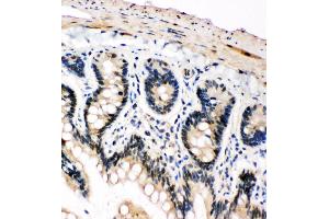 Immunohistochemistry (IHC) image for anti-Polo-Like Kinase 2 (PLK2) (AA 666-685), (C-Term) antibody (ABIN3043982)