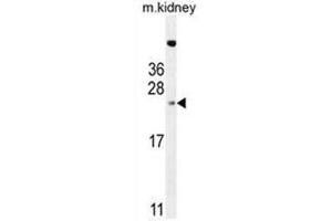 ADO Antibody (C-term) western blot analysis in mouse kidney tissue lysates (35µg/lane).