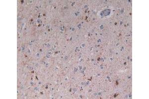 IHC-P analysis of Human Brain Tissue, with DAB staining. (Beclin 1 抗体  (AA 1-273))