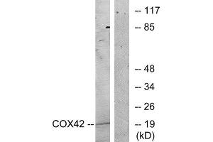 Western Blotting (WB) image for anti-Cytochrome C Oxidase Subunit IV Isoform 2 (Lung) (COX4I2) (Internal Region) antibody (ABIN1850324) (COX4I2 抗体  (Internal Region))