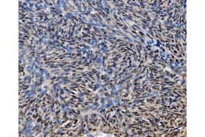 IHC analysis of CDC27 using anti-CDC27 antibody (ABIN7602163).