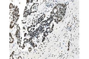 IHC analysis of NRF1 using anti-NRF1 antibody (ABIN7600874).