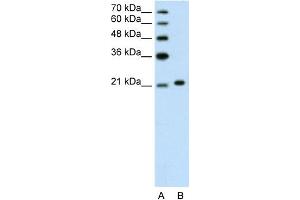 WB Suggested Anti-ANK1 Antibody Titration:  1. (Erythrocyte Ankyrin 抗体  (C-Term))