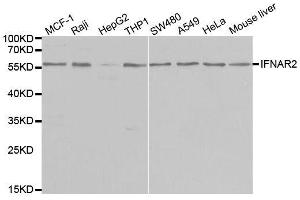 Western blot analysis of extracts of various cell lines, using IFNAR2 antibody. (IFNAR2 抗体  (AA 27-243))