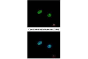 ICC/IF Image Immunofluorescence analysis of paraformaldehyde-fixed HeLa, using IRF5, antibody at 1:500 dilution. (IRF5 抗体  (C-Term))
