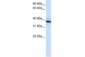 OAS1 antibody used at 1 ug/ml to detect target protein. (OAS1 抗体  (C-Term))