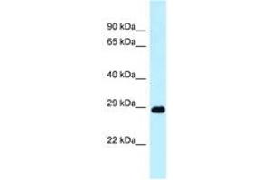 Image no. 1 for anti-DNA-Damage Regulated Autophagy Modulator 1 (DRAM1) (N-Term) antibody (ABIN6747924) (DRAM 抗体  (N-Term))