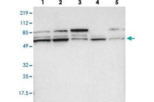 Western blot analysis of lane 1: RT-4, lane 2: EFO-21, lane 3: A-431, lane 4: Liver and lane 5: Tonsil using PCTK1 polyclonal antibody . (CDK16 抗体)