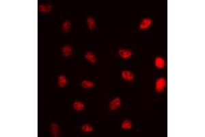 Immunofluorescent analysis of ERCC5 staining in A549 cells.