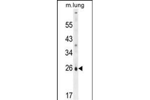 PQLC1 Antibody (Center) (ABIN654821 and ABIN2844494) western blot analysis in mouse lung tissue lysates (35 μg/lane). (PQLC1 抗体  (AA 100-128))