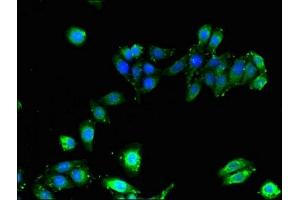 Immunofluorescent analysis of HepG2 cells using ABIN7155621 at dilution of 1:100 (HLA-B 抗体  (AA 25-308))