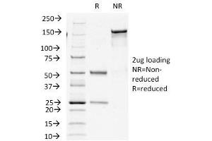 SDS-PAGE Analysis Purified Insulin Mouse Monoclonal Antibody (E2-E3+2D11-H5). (Insulin 抗体)
