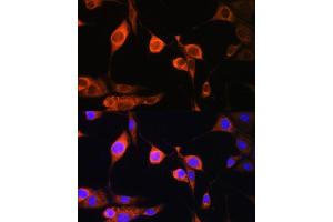 Immunofluorescence (IF) image for anti-ATP synthase subunit delta, mitochondrial (ATP5F1D) (AA 1-168) antibody (ABIN6137329)