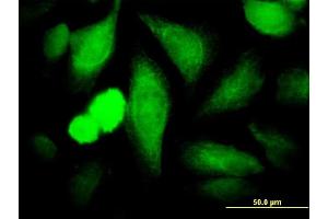 Immunofluorescence of monoclonal antibody to COPS3 on HeLa cell. (COPS3 抗体  (AA 324-422))