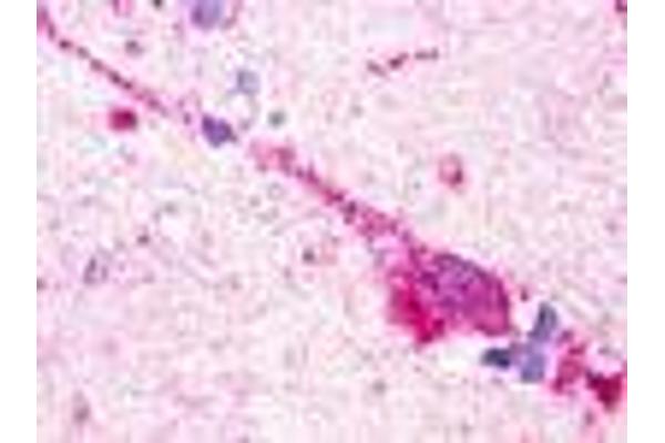GPR174 抗体  (Extracellular Domain)