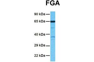 Host:  Rabbit  Target Name:  FGA  Sample Tissue:  Human NCI-H226  Antibody Dilution:  1. (FGA 抗体  (Middle Region))