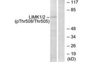 Western blot analysis of extracts from COLO205 cells, using LIMK1 (Phospho-Thr508) Antibody. (LIM Domain Kinase 1 抗体  (pThr508))