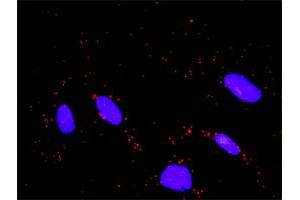 Proximity Ligation Analysis of protein-protein interactions between WEE1 and FBXW11. (WEE1 抗体  (AA 1-646))