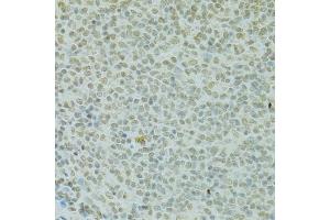 Immunohistochemistry of paraffin-embedded rat spleen using RCC1 antibody (ABIN5973761) at dilution of 1/100 (40x lens). (RCC1 抗体)