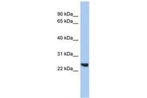 Image no. 1 for anti-Proteasome (Prosome, Macropain) Subunit, beta Type 2 (PSMB2) (C-Term) antibody (ABIN6744081)