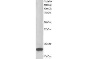 Image no. 1 for anti-Parkinson Protein 7 (PARK7) (C-Term) antibody (ABIN374310) (PARK7/DJ1 抗体  (C-Term))