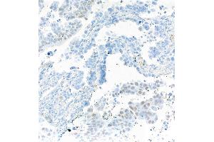 Immunohistochemistry (IHC) image for anti-SRY (Sex Determining Region Y)-Box 2 (SOX2) antibody (ABIN7449421) (SOX2 抗体)