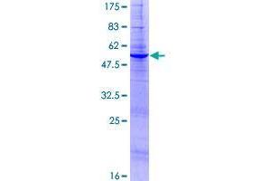DOLPP1 Protein (AA 1-238) (GST tag)