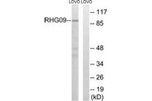 Western blot analysis of extracts from LOVO cells, using RHG9 Antibody.
