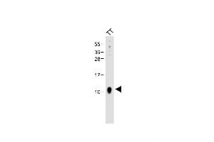 Anti-CALCA Antibody (Center) at 1:2000 dilution + TT whole cell lysate Lysates/proteins at 20 μg per lane. (CGRP 抗体  (AA 56-83))