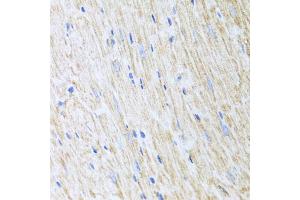 Immunohistochemistry of paraffin-embedded mouse heart using RCN2 antibody (ABIN5975169) at dilution of 1/100 (40x lens). (RCN2 抗体)