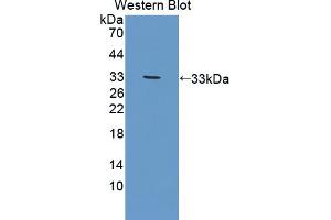 Western blot analysis of the recombinant protein. (DOK3 抗体  (AA 45-310))