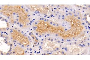 Detection of ERK1 in Human Kidney Tissue using Monoclonal Antibody to Extracellular Signal Regulated Kinase 1 (ERK1) (ERK1 抗体  (AA 75-312))