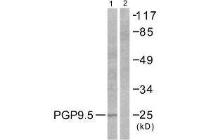 Western Blotting (WB) image for anti-Ubiquitin Carboxyl-terminal Esterase L1 (Ubiquitin Thiolesterase) (UCHL1) (C-Term) antibody (ABIN1848743) (UCHL1 抗体  (C-Term))